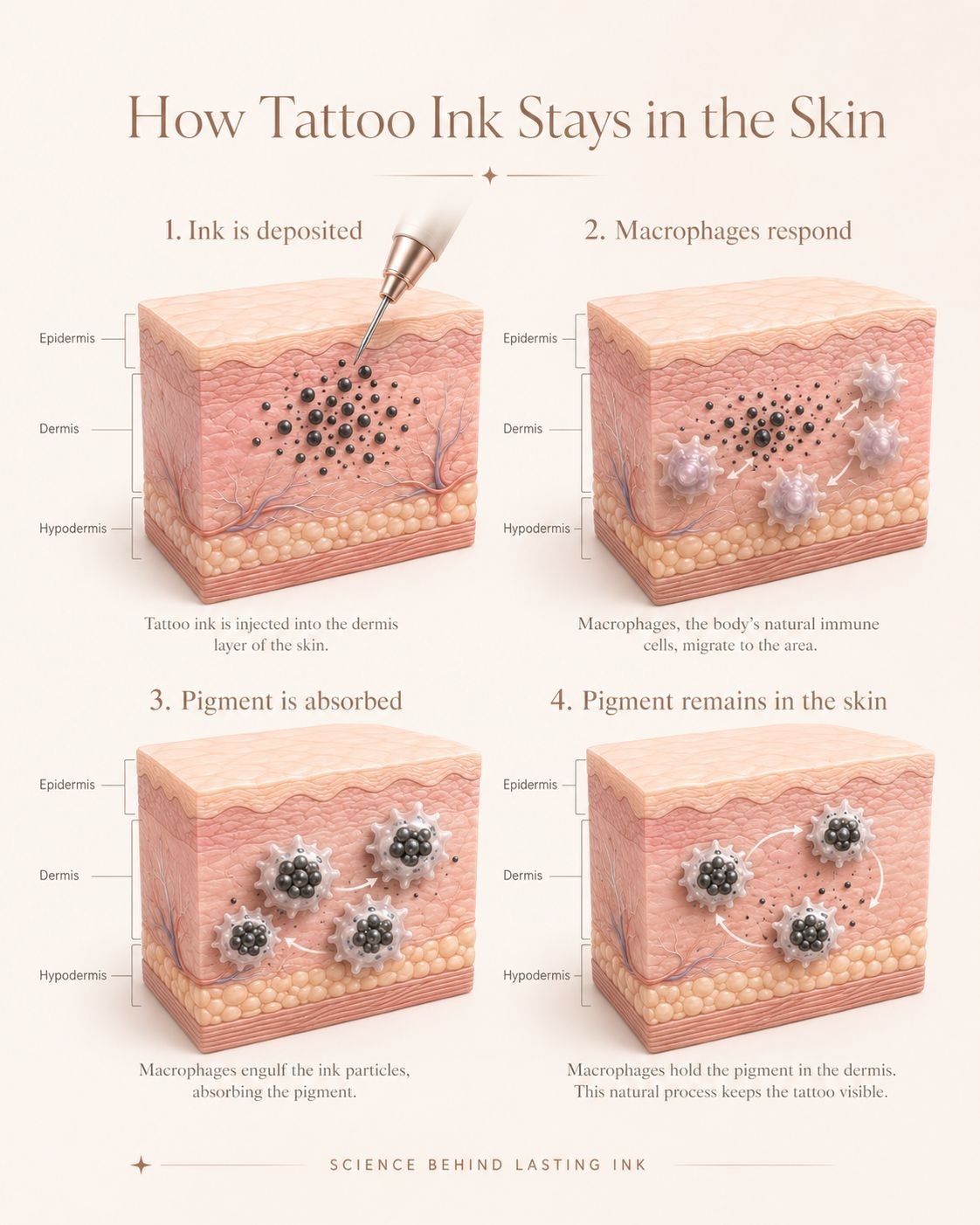 Diagram showing how tattoo ink stays in the skin: ink is deposited in the dermis, macrophages respond and hold the pigment in place